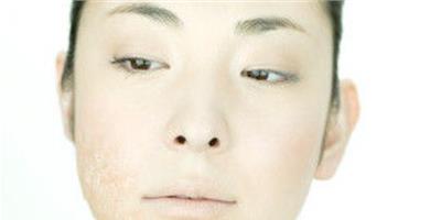 警惕皮膚空調病 拯救常吹空調的問題肌