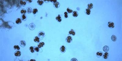 生活小常識：酵母菌的生殖方式